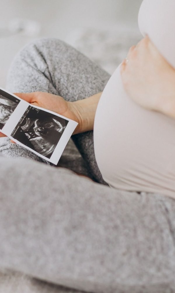 Wat moet je regelen voor een echo